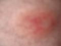 23 March 2005 - Sean's arse 043